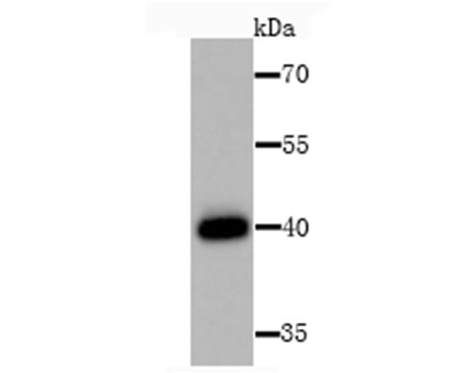 HLA Class I Antibody Western Blot: HLA Class I Antibody [NBP2-75928]