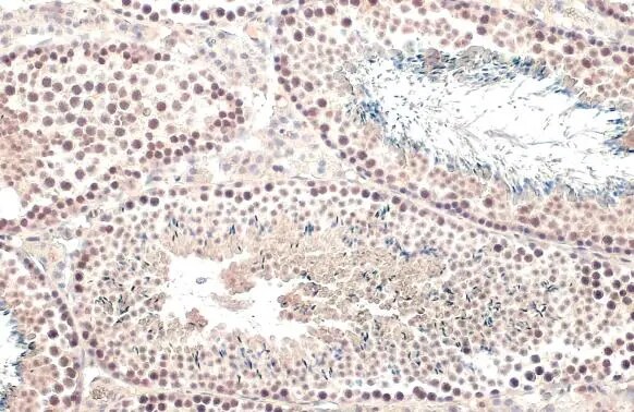 TET1 Antibody