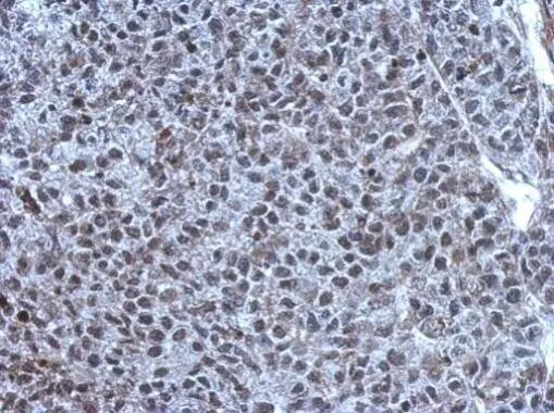 TET1 Antibody