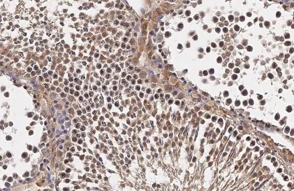 TET1 Antibody
