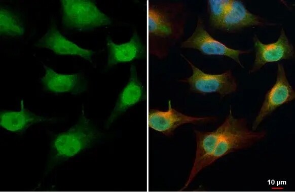 TET1 Antibody