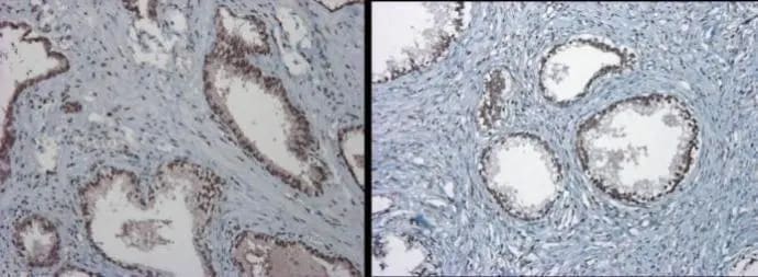 TET1 Antibody