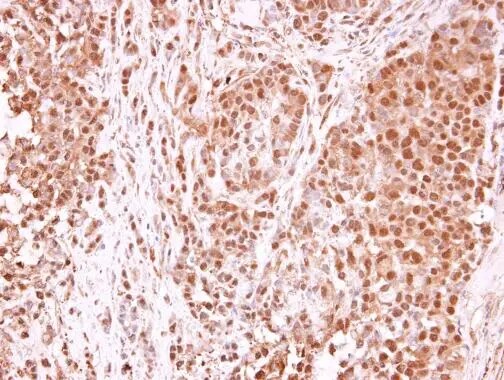 TET1 Antibody