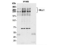 KMT2A/MLL Antibody (BL-175-7E8)