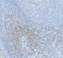 CD4 Antibody (BL-155-1C11)