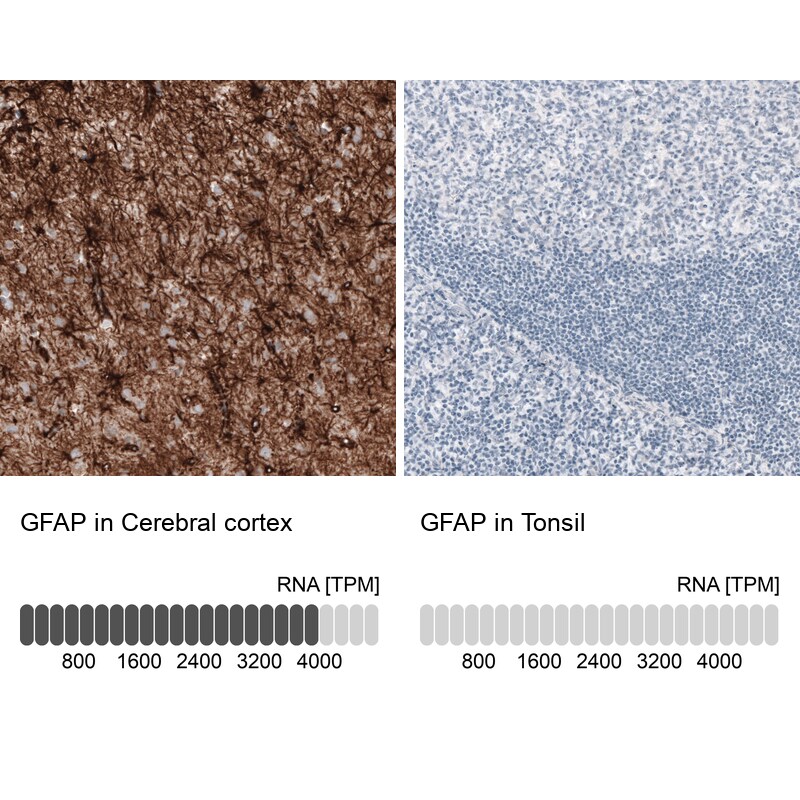 GFAP Antibody (CL2713) - BSA Free Immunohistochemistry: GFAP Antibody (CL2713) [NBP3-52487]