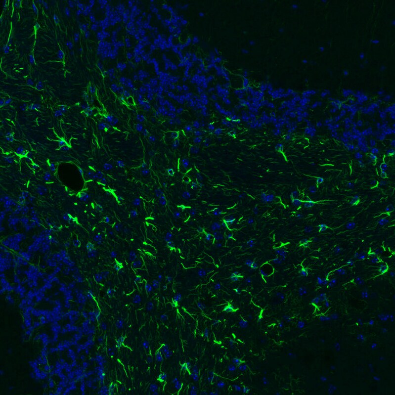 GFAP Antibody (CL2713) - BSA Free Immunohistochemistry: GFAP Antibody (CL2713) [NBP3-52487]