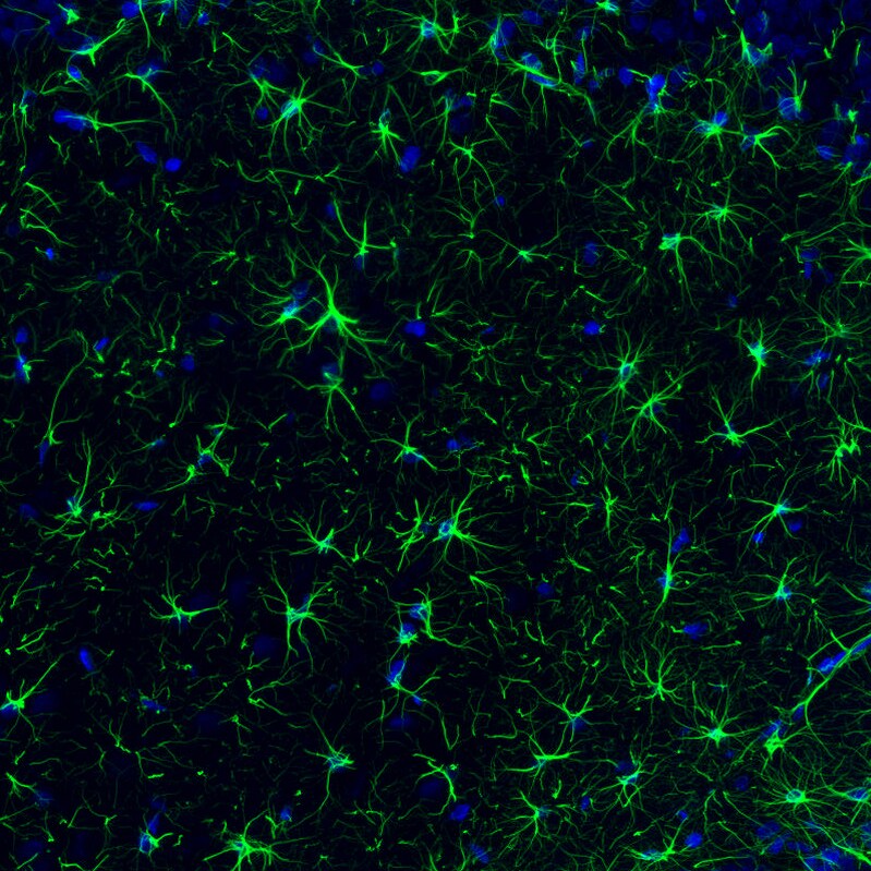 GFAP Antibody (CL2713) - BSA Free Immunohistochemistry: GFAP Antibody (CL2713) [NBP3-52487]