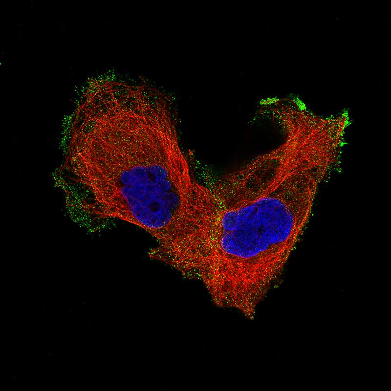 Integrin beta 8 Antibody (CL7290) - BSA Free Immunocytochemistry/ Immunofluorescence: Integrin beta 8 Antibody (CL7290) - BSA Free[NBP2-76480]