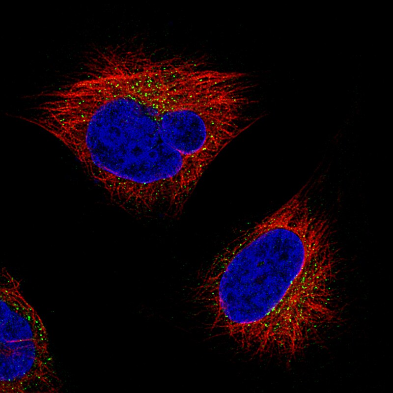 beta-Actin Antibody (CL3868) Immunocytochemistry/Immunofluorescence: Fibulin 1 Antibody (CL0337) [NBP2-52918]