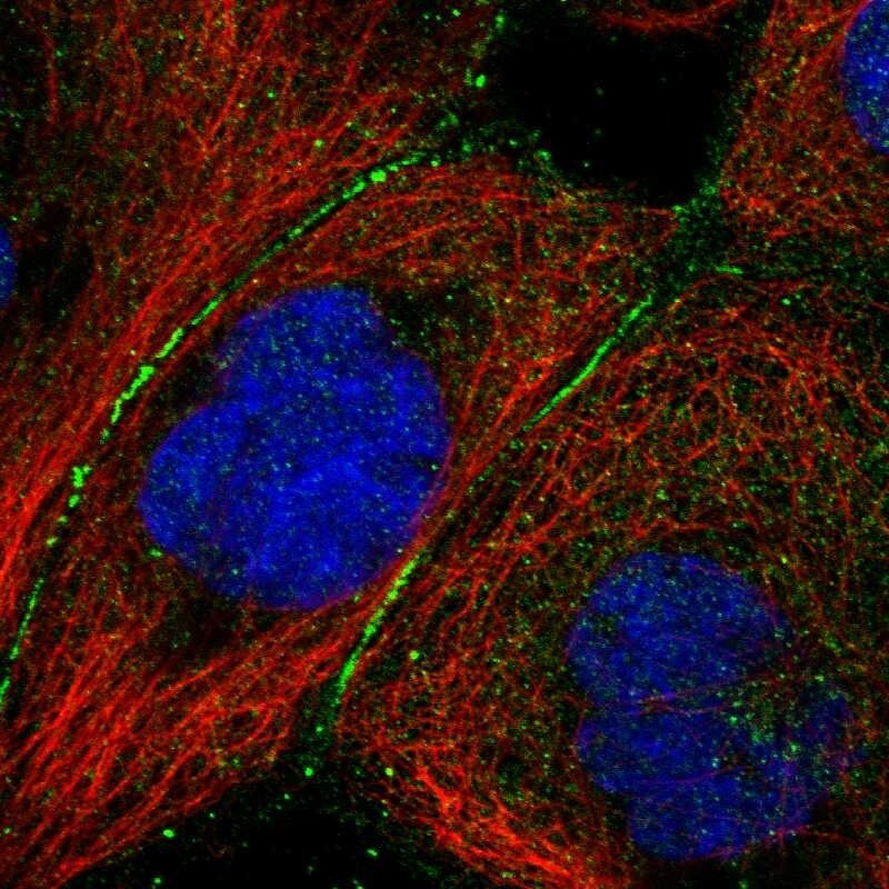 Complement Factor B Antibody - BSA Free Immunocytochemistry/ Immunofluorescence: Complement Factor B Antibody - BSA Free [NBP2-76494]