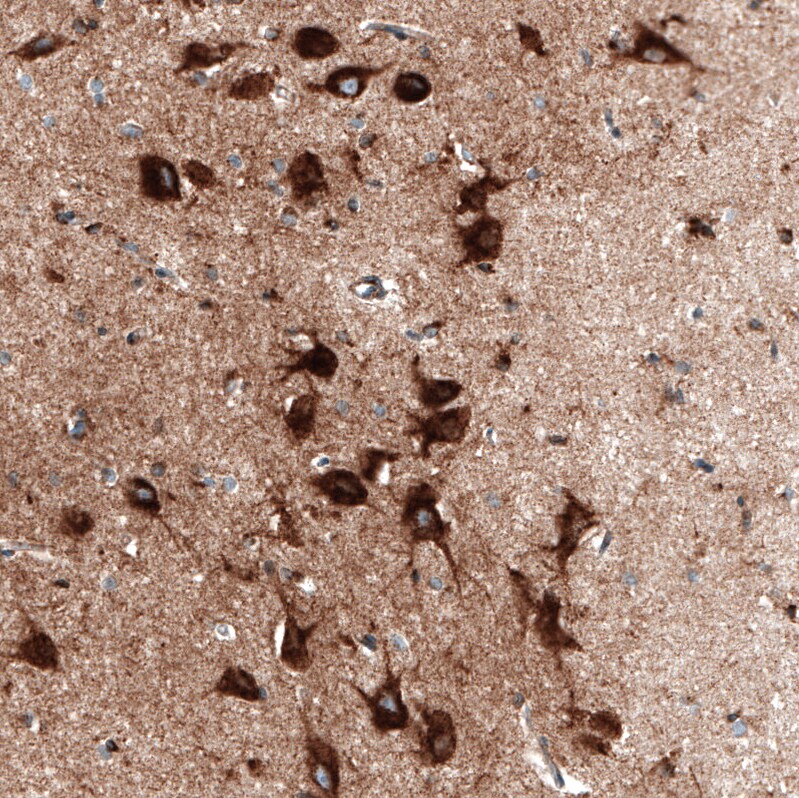 Sortilin Antibody (CL6526) - BSA Free Immunohistochemistry: Sortilin Antibody (CL6526) [NBP3-52483]