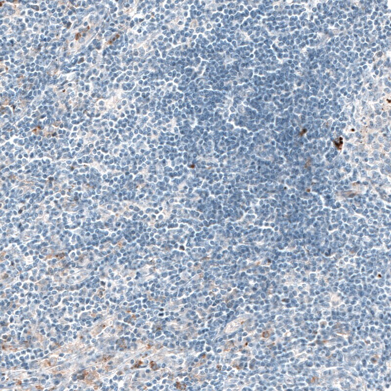 Sortilin Antibody (CL6526) - BSA Free Immunohistochemistry: Sortilin Antibody (CL6526) [NBP3-52483]