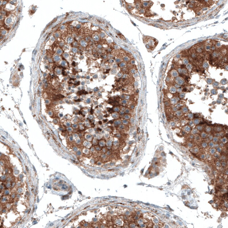 Sortilin Antibody (CL6526) - BSA Free Immunohistochemistry: Sortilin Antibody (CL6526) [NBP3-52483]
