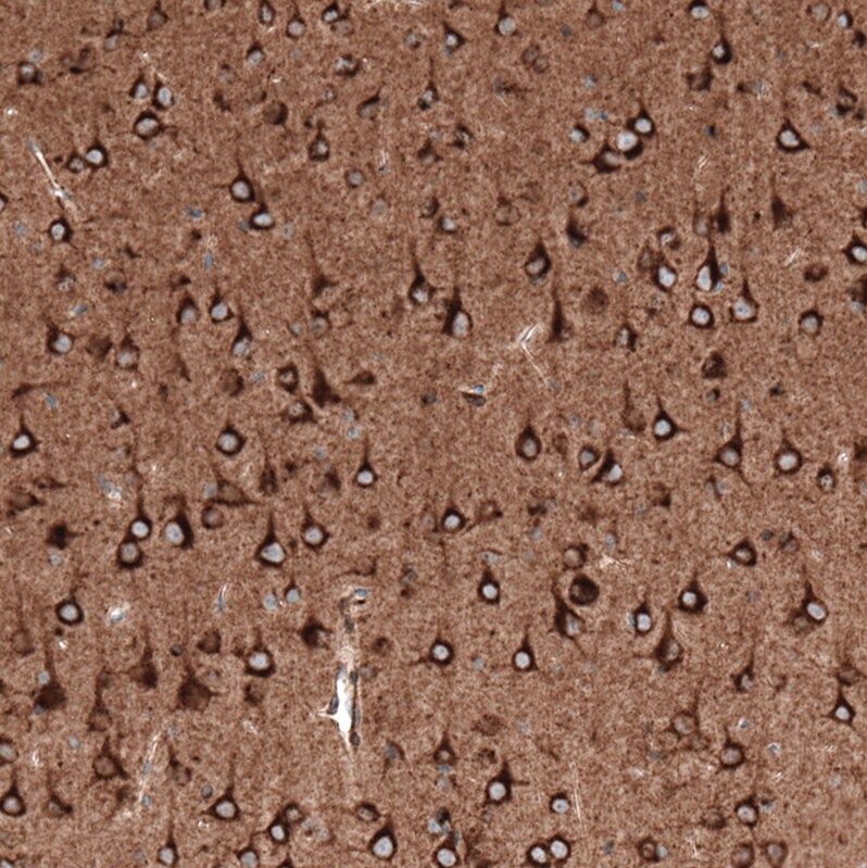 Sortilin Antibody (CL6526) - BSA Free Immunohistochemistry: Sortilin Antibody (CL6526) [NBP3-52483]