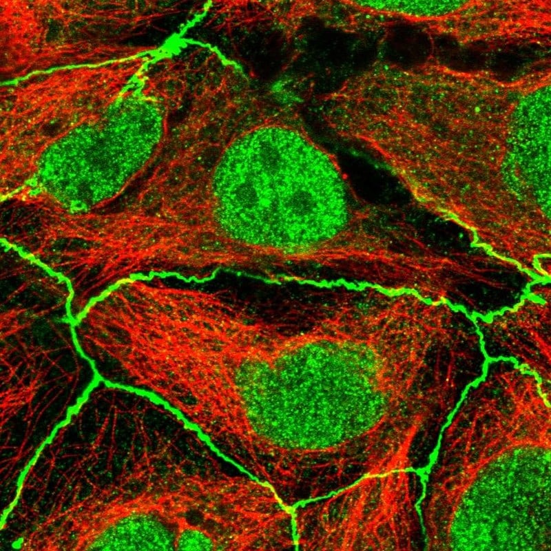 PDGFR alpha Antibody - BSA Free Immunocytochemistry/ Immunofluorescence: PDGFR alpha Antibody - BSA Free [NBP2-76508]