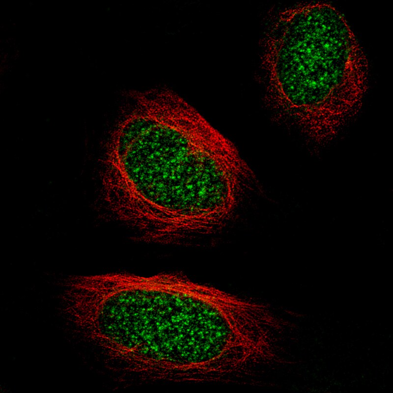 TET2 Antibody (CL6873) - BSA Free Immunocytochemistry/ Immunofluorescence: TET2 Antibody (CL6873) [NBP2-76510]
