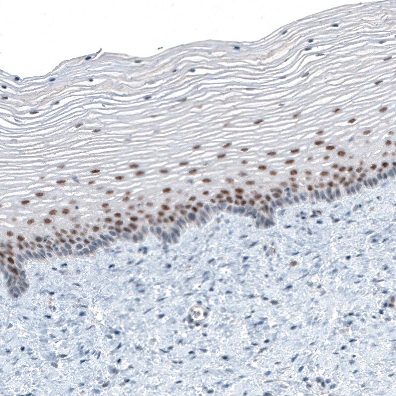 TET2 Antibody (CL6873) - BSA Free Immunohistochemistry: TET2 Antibody (CL6873) [NBP3-52484]