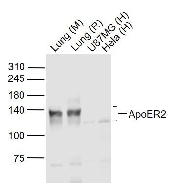 Apolipoprotein E R2/ApoE R2 Antibody Western Blot: Apolipoprotein E R2/ApoE R2 Antibody [NBP2-76911]
