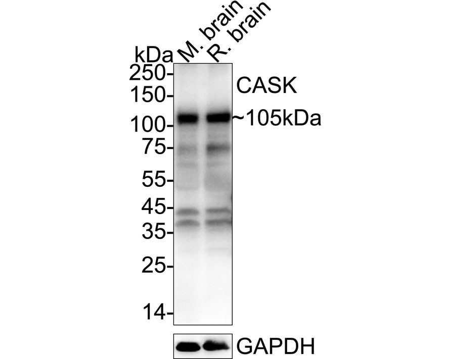 CASK Antibody Western Blot: CASK Antibody [NBP2-76922]