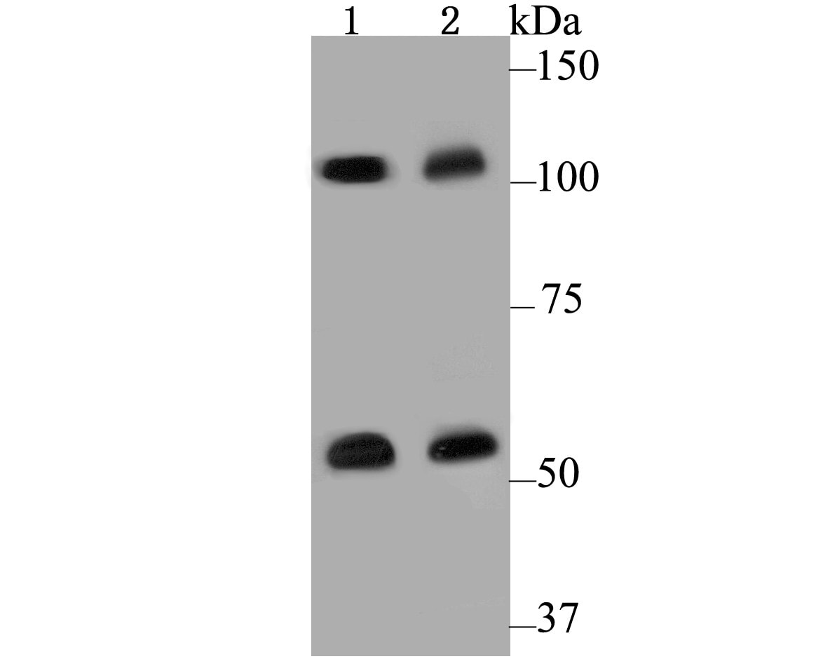 CASK Antibody Western Blot: CASK Antibody [NBP2-76922]