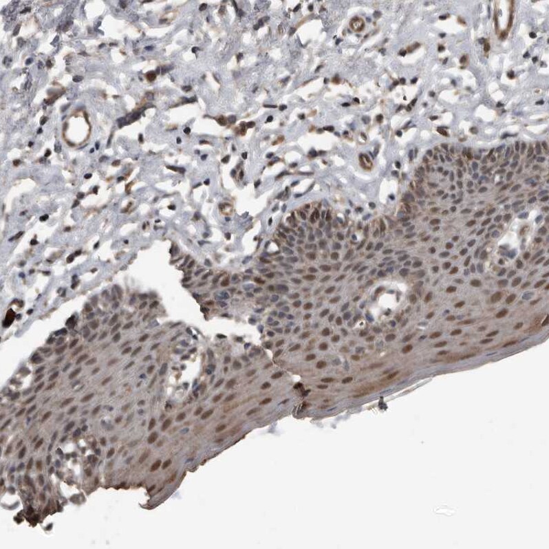 FSBP Antibody - BSA Free Immunohistochemistry-Paraffin: FSBP Antibody [NBP2-76996]