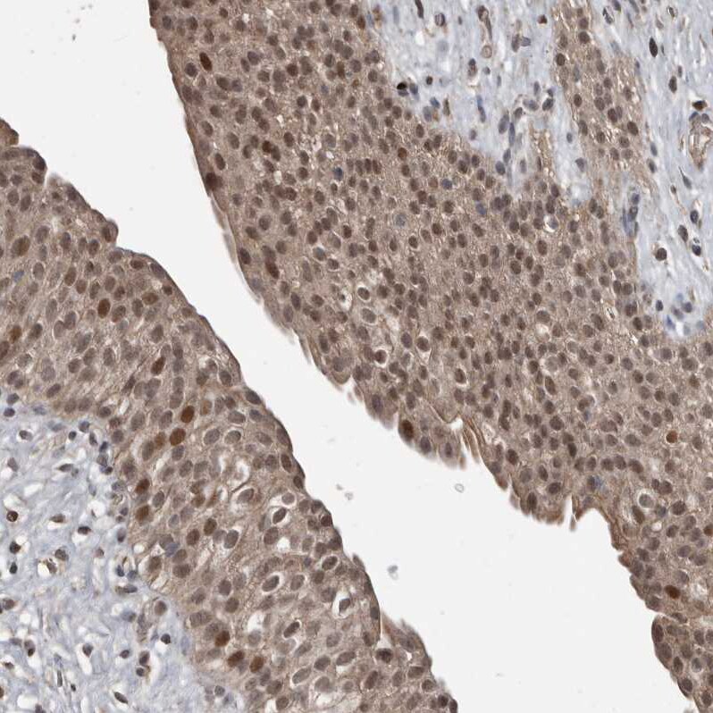 FSBP Antibody - BSA Free Immunohistochemistry-Paraffin: FSBP Antibody [NBP2-76996]
