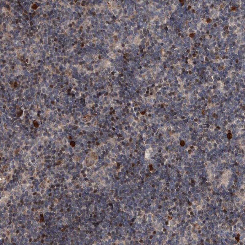 FSBP Antibody - BSA Free Immunohistochemistry-Paraffin: FSBP Antibody [NBP2-76996]
