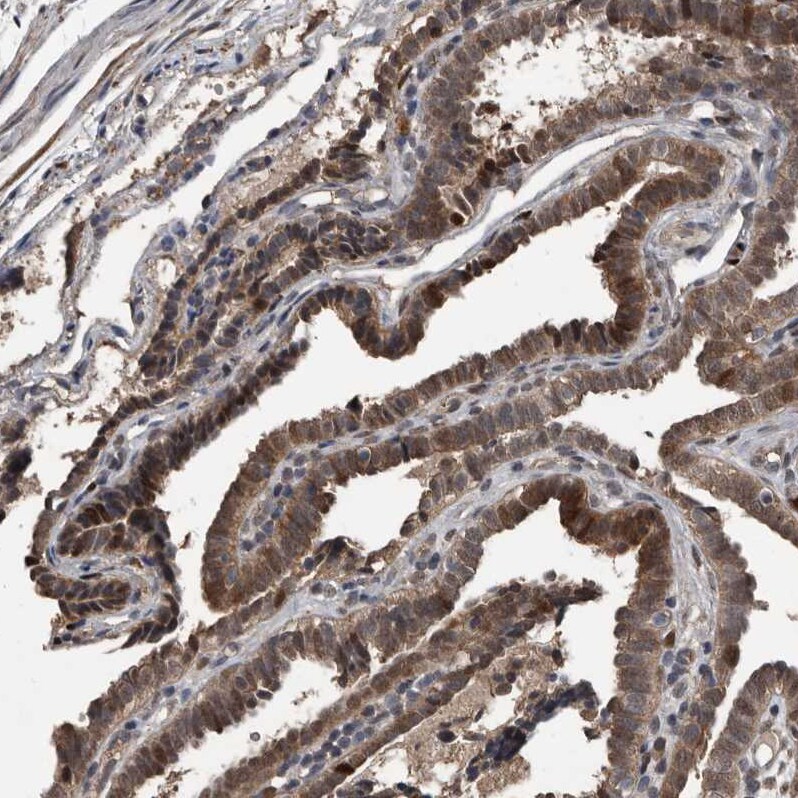 FSBP Antibody - BSA Free Immunohistochemistry-Paraffin: FSBP Antibody [NBP2-76996]