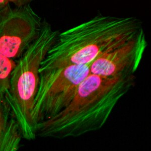 Acetyl-Lysine Antibody (RM101)