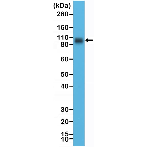 B7-H3/CD276 Antibody (RM335)