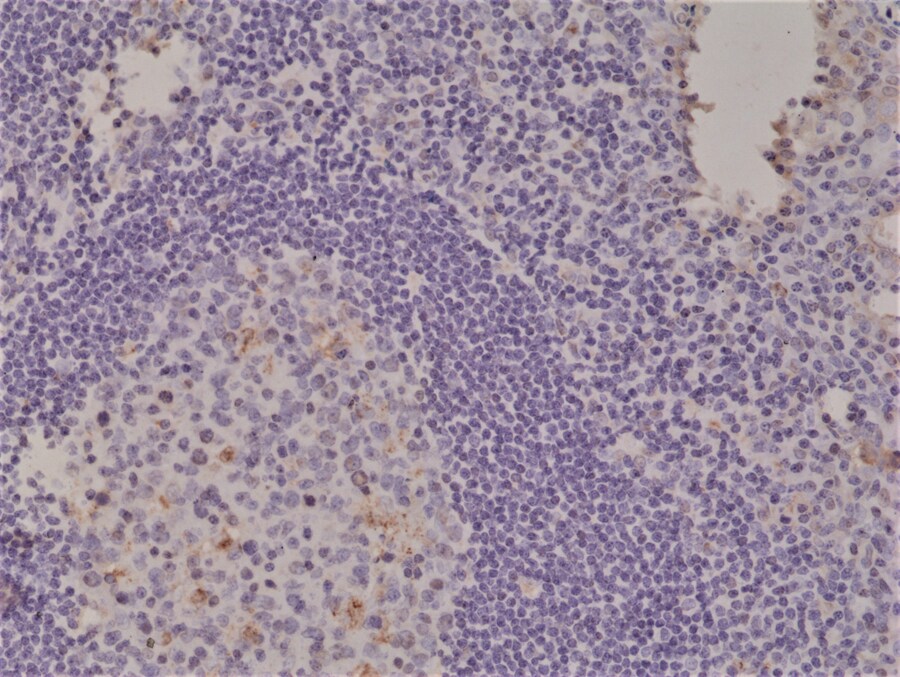 Spastin Antibody (RM346)