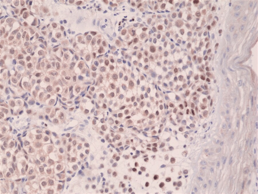 IRF4 Antibody (RM352)