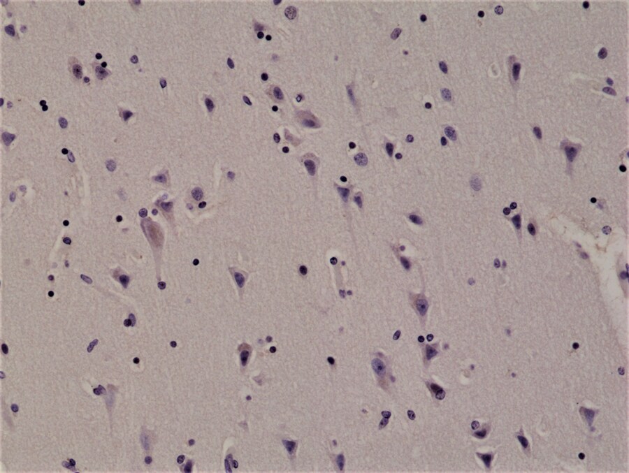 ALK/CD246 Antibody (RM361)