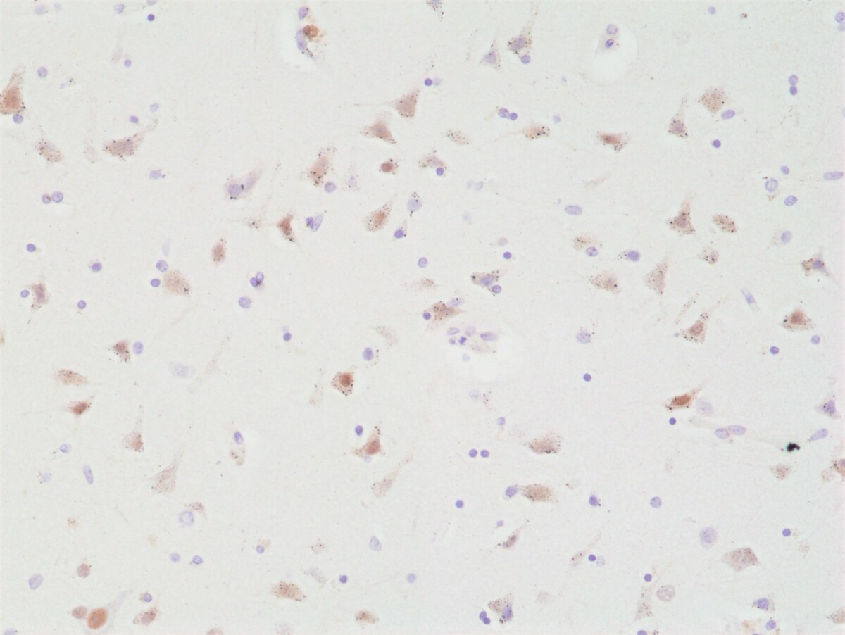 SATB2 Antibody (RM365)