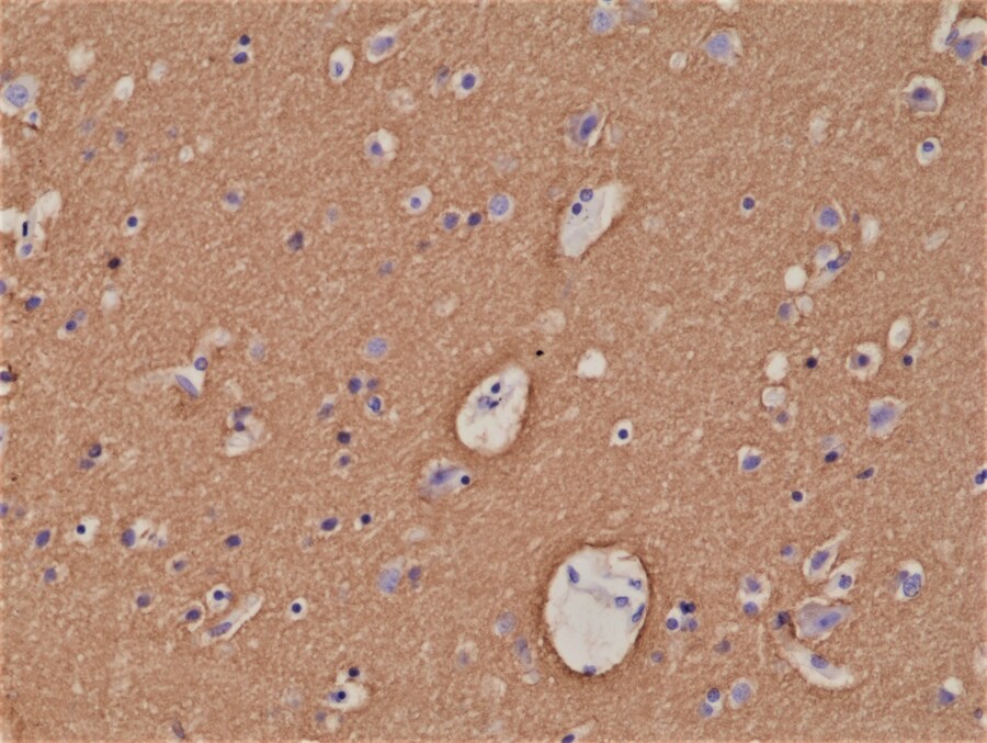 Syntaxin 1A Antibody (RM367)