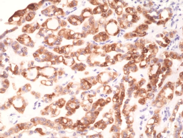 Thyroid Peroxidase Antibody (RM368)