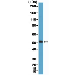 MyoD Antibody (RM369)