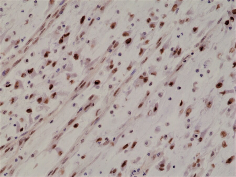 MyoD Antibody (RM369)