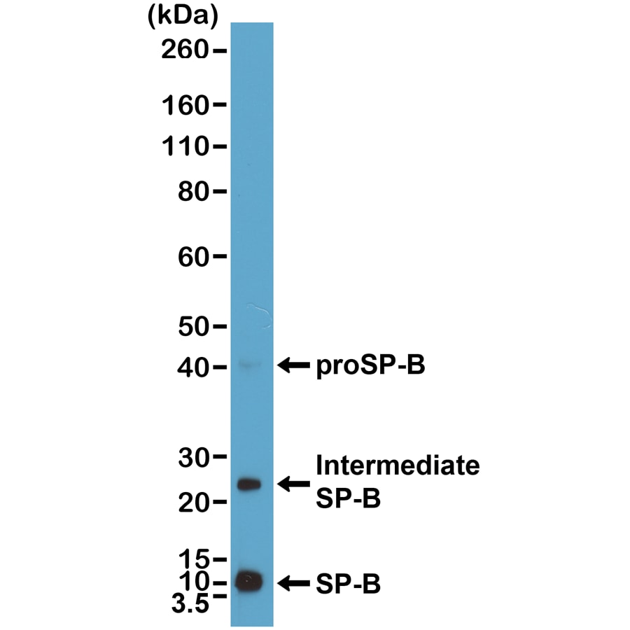 SP-B/Surfactant Protein B Antibody (RM370)