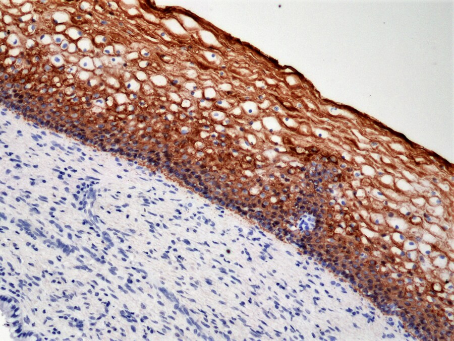 Cytokeratin 5/6 Antibody (RM341)