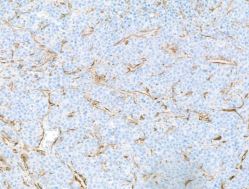 alpha-Smooth Muscle Actin Antibody (BLR082G)