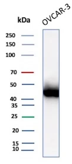 Mesothelin Antibody (MSLN/2131) Western Blot: Mesothelin Antibody (MSLN/2131) [NBP2-79724] -