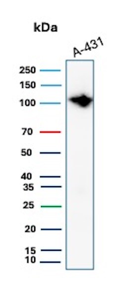 MCM6 Antibody (MCM6/2999) Western Blot: MCM6 Antibody (MCM6/2999) [NBP2-79727] -