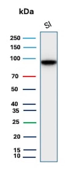 Cadherin-17 Antibody (CDH17/2618) - BSA Free Western Blot: Cadherin-17 Antibody (CDH17/2618) - BSA Free [NBP2-79857] -