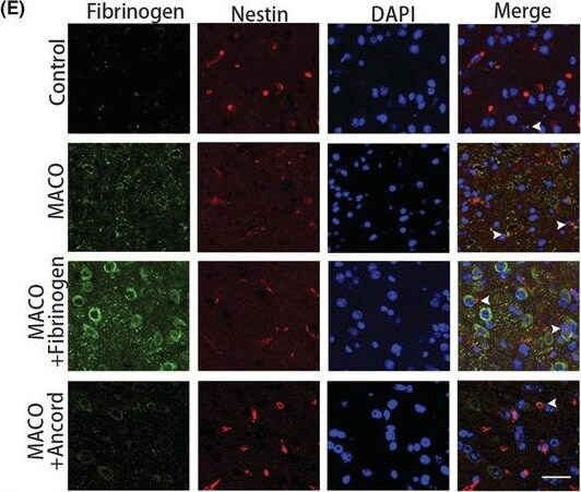 Fibrinogen Antibody