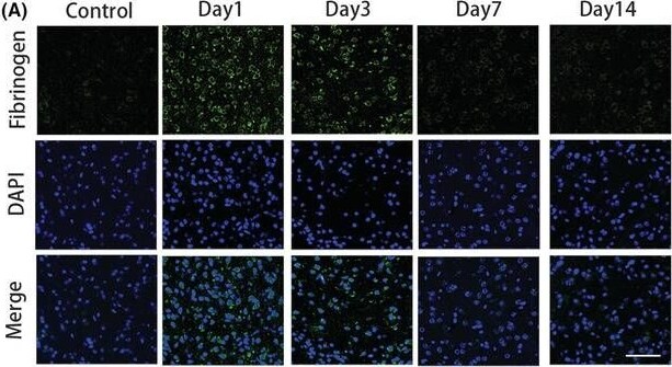 Fibrinogen Antibody
