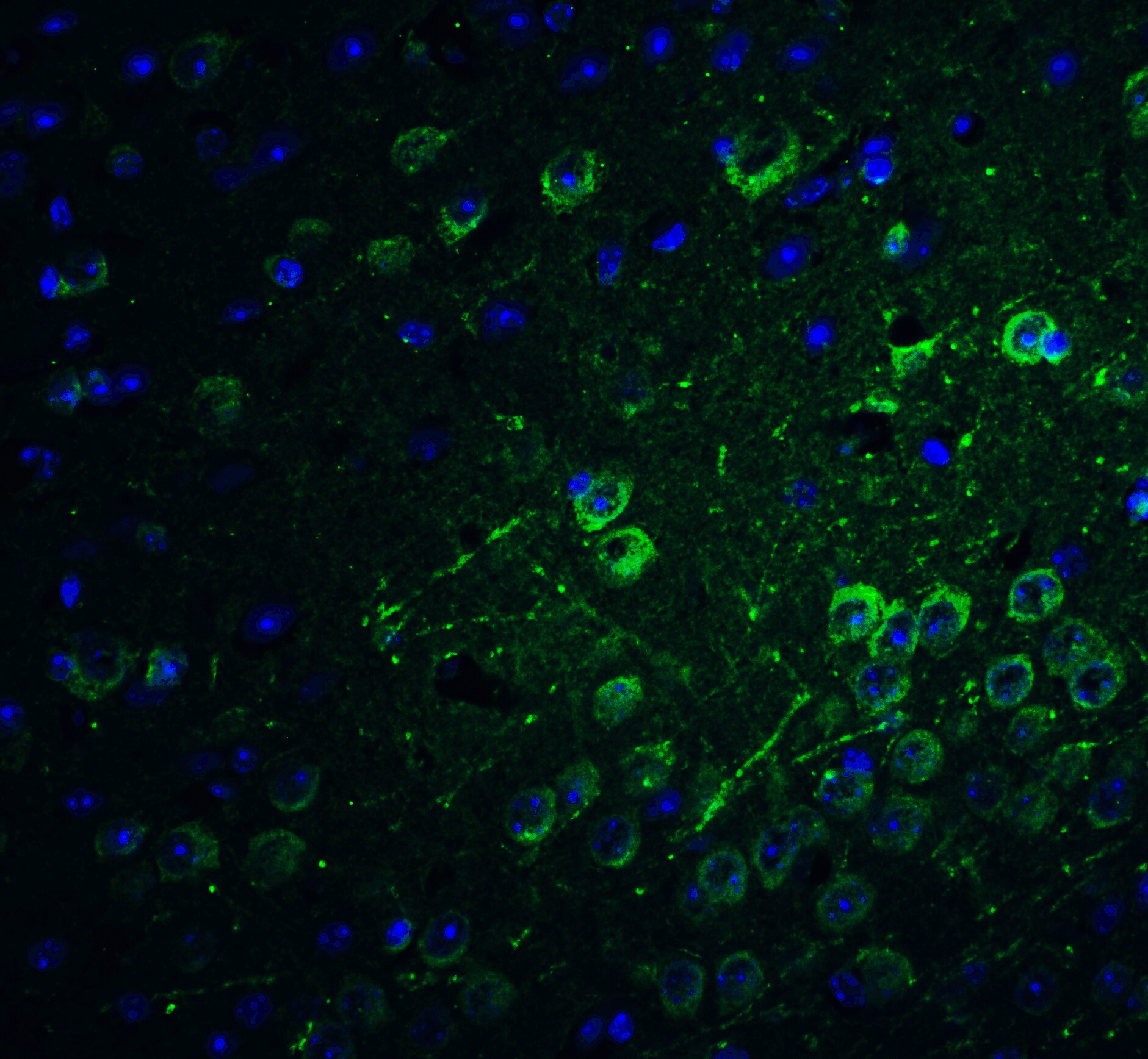 PACS1 Antibody - BSA Free