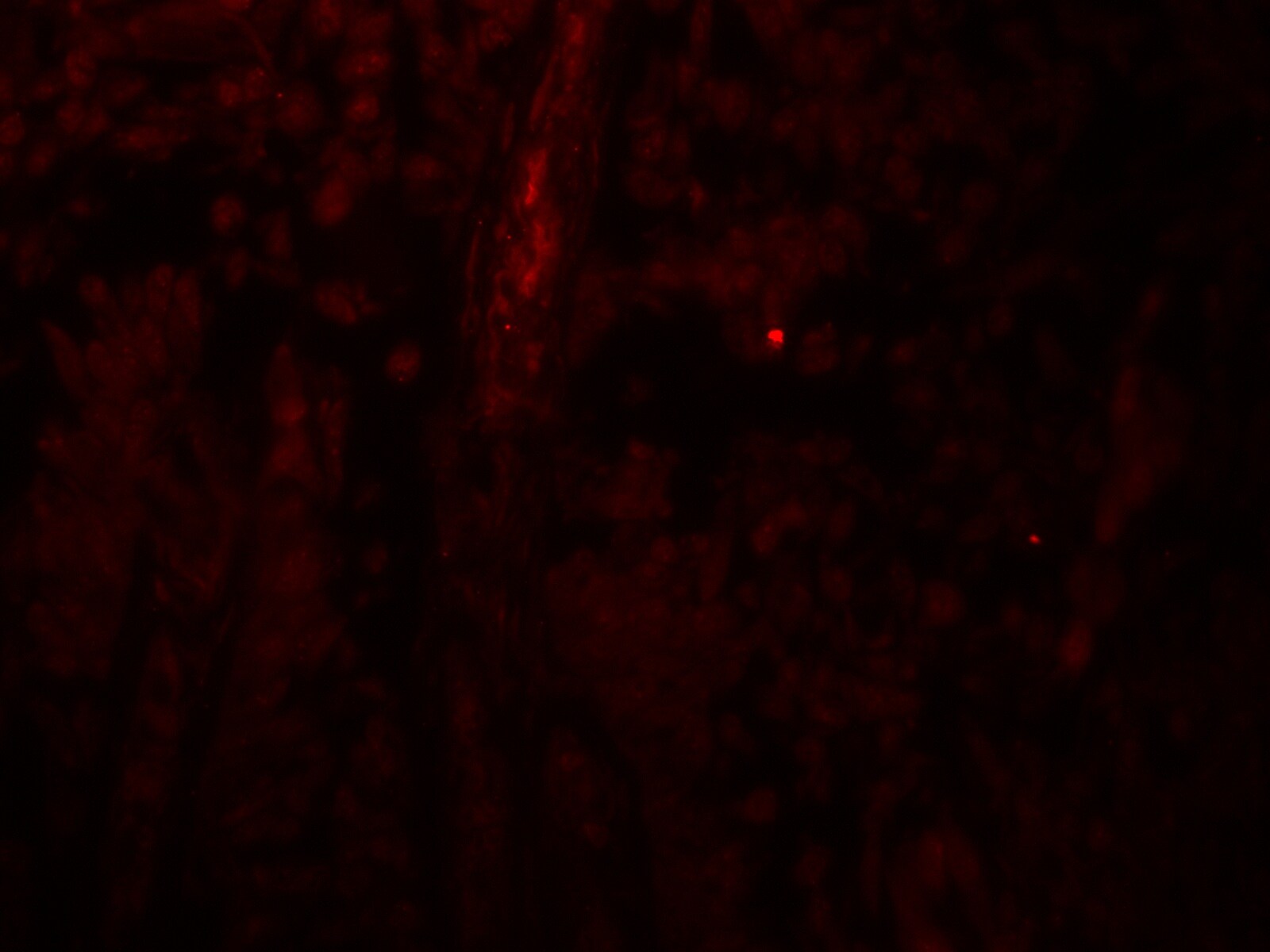 PACS1 Antibody - BSA Free