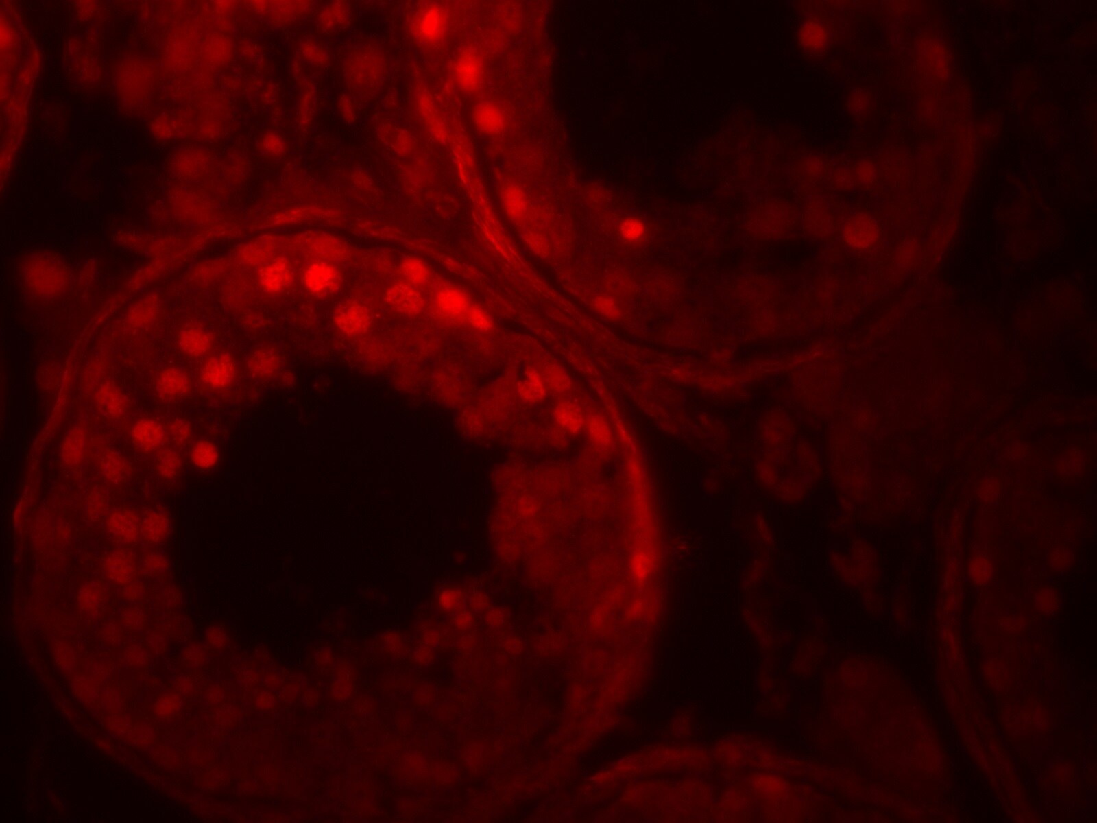 ADAM29 Antibody - BSA Free